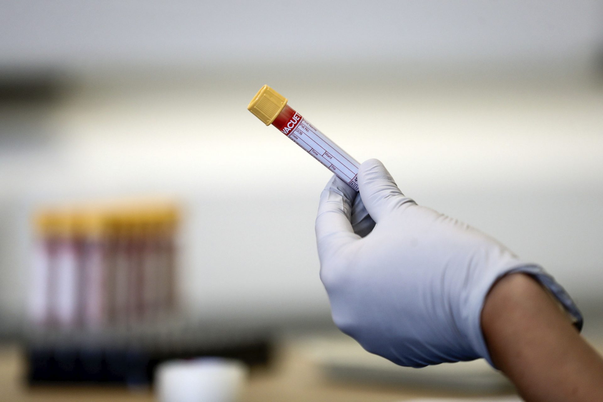 A paramedic holds a test tube containing a blood sample at a coronavirus antibody testing program at the Hollymore Ambulance Hub, in Birmingham, England, on Friday, June 5, 2020.