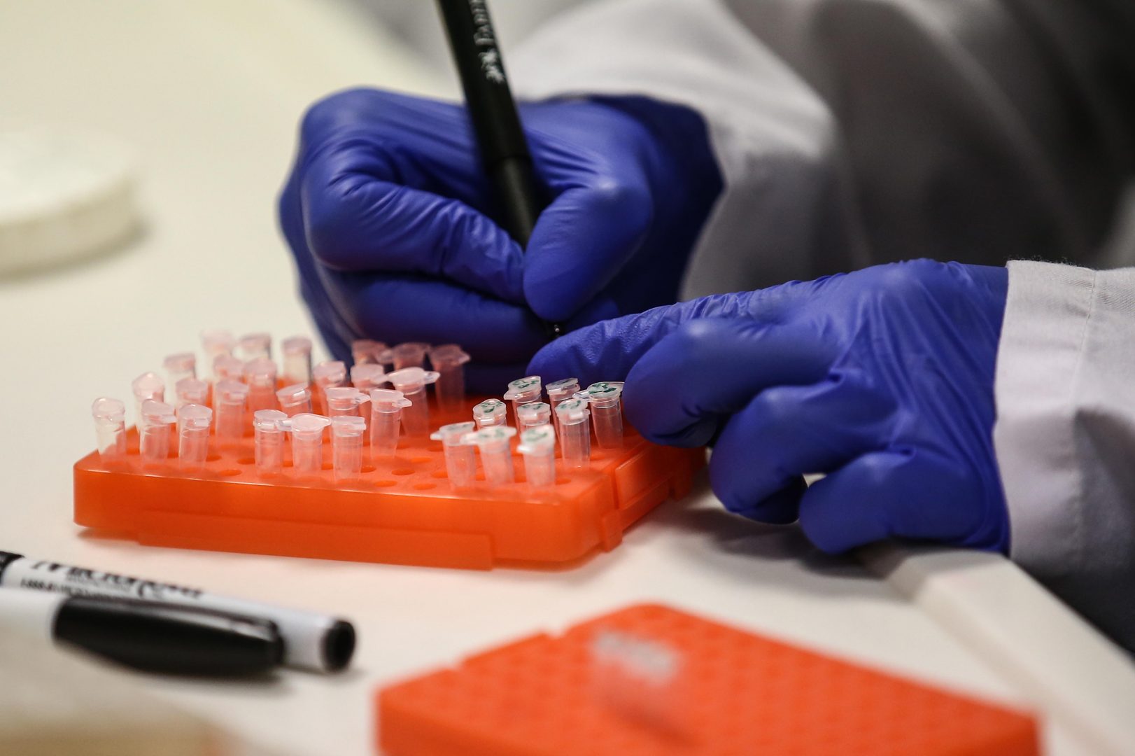 ISTANBUL, TURKEY - AUGUST 28: A scientist is seen during the vaccination innovation process as Prof. Dr. Nesrin Ozoren and her team started to animal experiments phase at Molecular Biology and Genetics Department Laboratory of Bogazici University in Istanbul, Turkey on August 28, 2020. They are one of the vaccine working groups of the novel coronavirus (COVID-19), created under the coordination of the Turkish Ministry of Industry and Technology and Scientific and Technological Research Council of Turkey (TUBITAK) at Molecular Biology and Genetics Department Laboratory. (Photo by Onur Coban/Anadolu Agency via Getty Images)