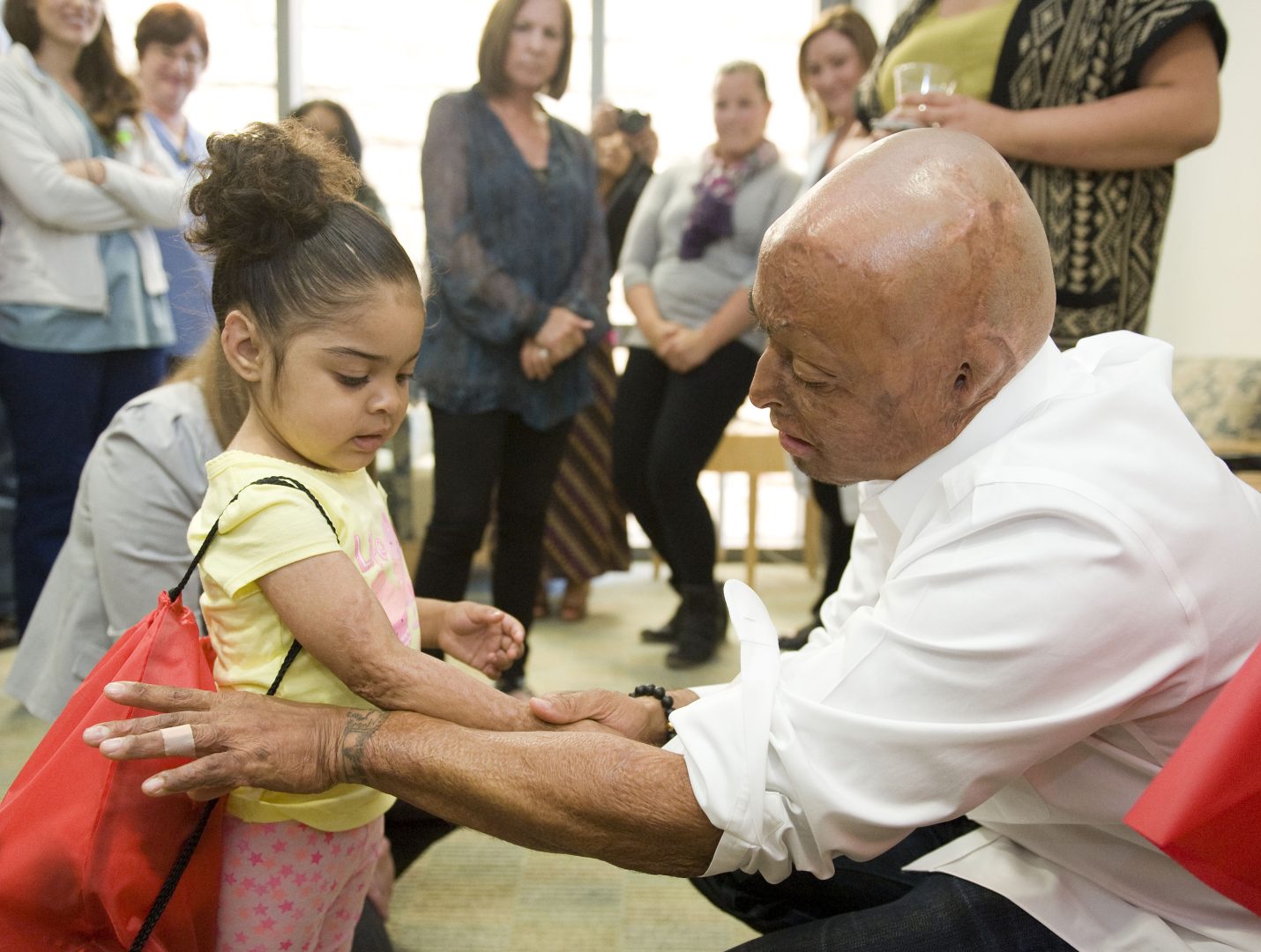 Burn survivor, Iraq war veteran and former Dancing With the Stars winner J.R. Martinez compares arms with fellow burn survivor Valentina Serrano, 2, of Compton, during a visit to the UC Irvine Health Regional Burn Center Wednesday afternoon. Martinez is representing the Phoenix Society for Burn Survivors, which brings together burn survivors, their families, caregivers, burn care professionals and firefighters to encourage the sharing of stories, support and knowledge of burn recovery.