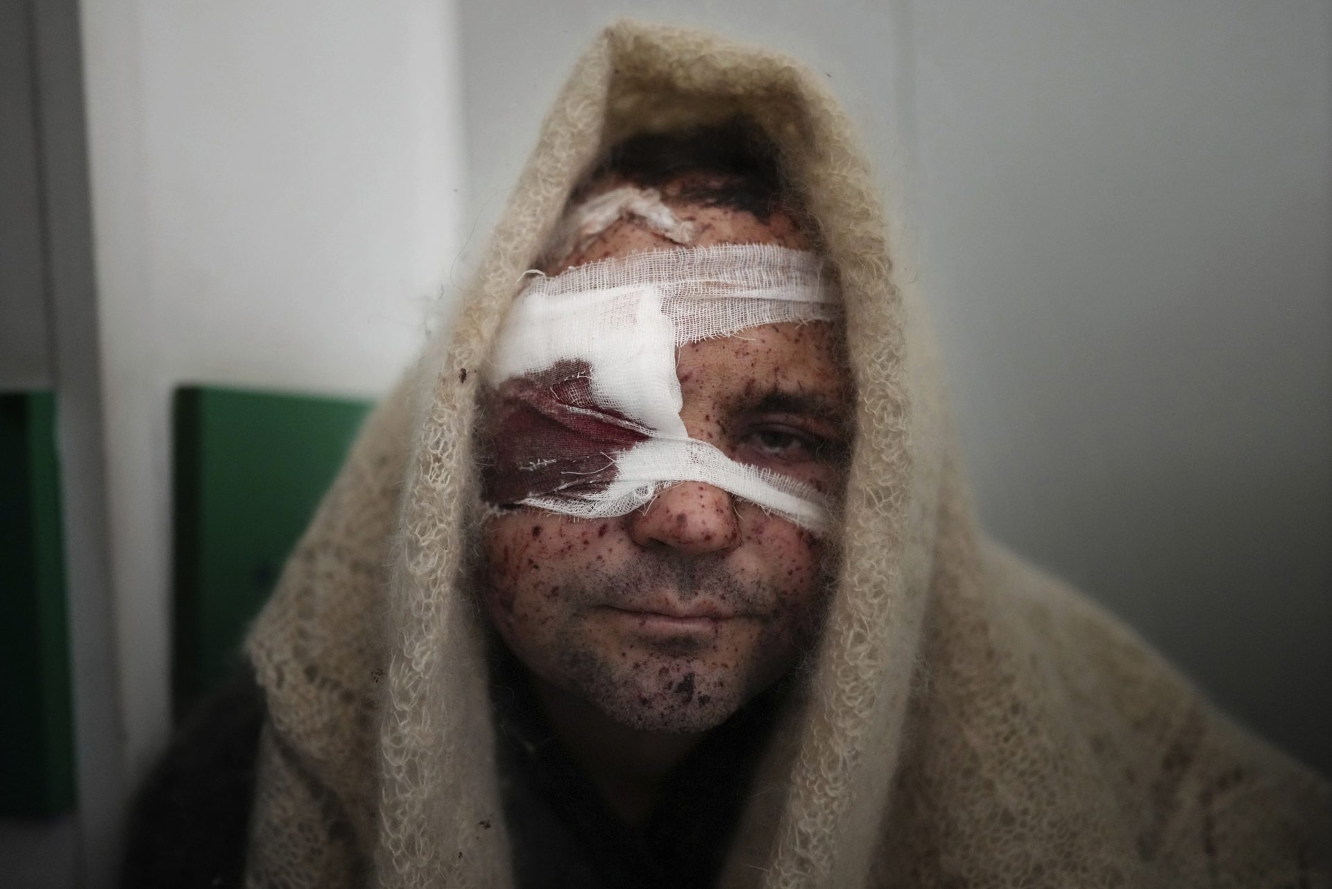 Serhiy Kralya, 41, looks at the camera after surgery at a hospital in Mariupol, eastern Ukraine on Friday, March 11, 2022. Kralya was injured during shelling by Russian forces.