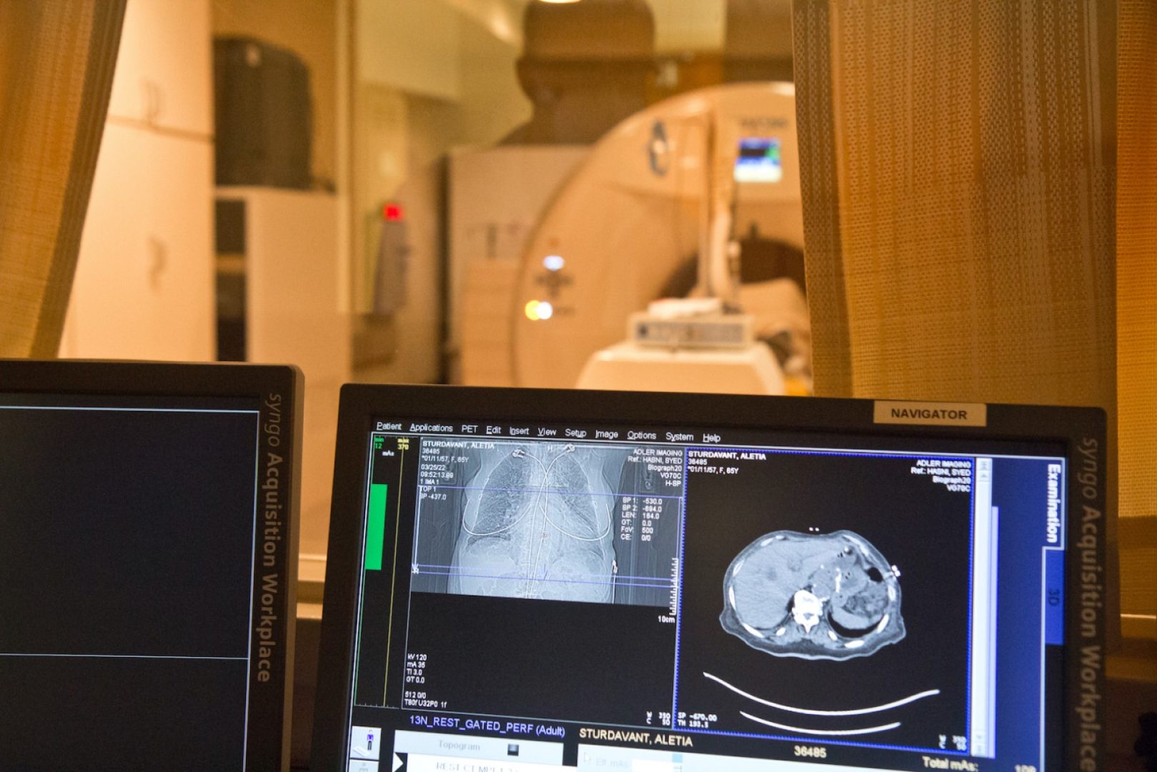 A PET scan in process at Adler Imaging.