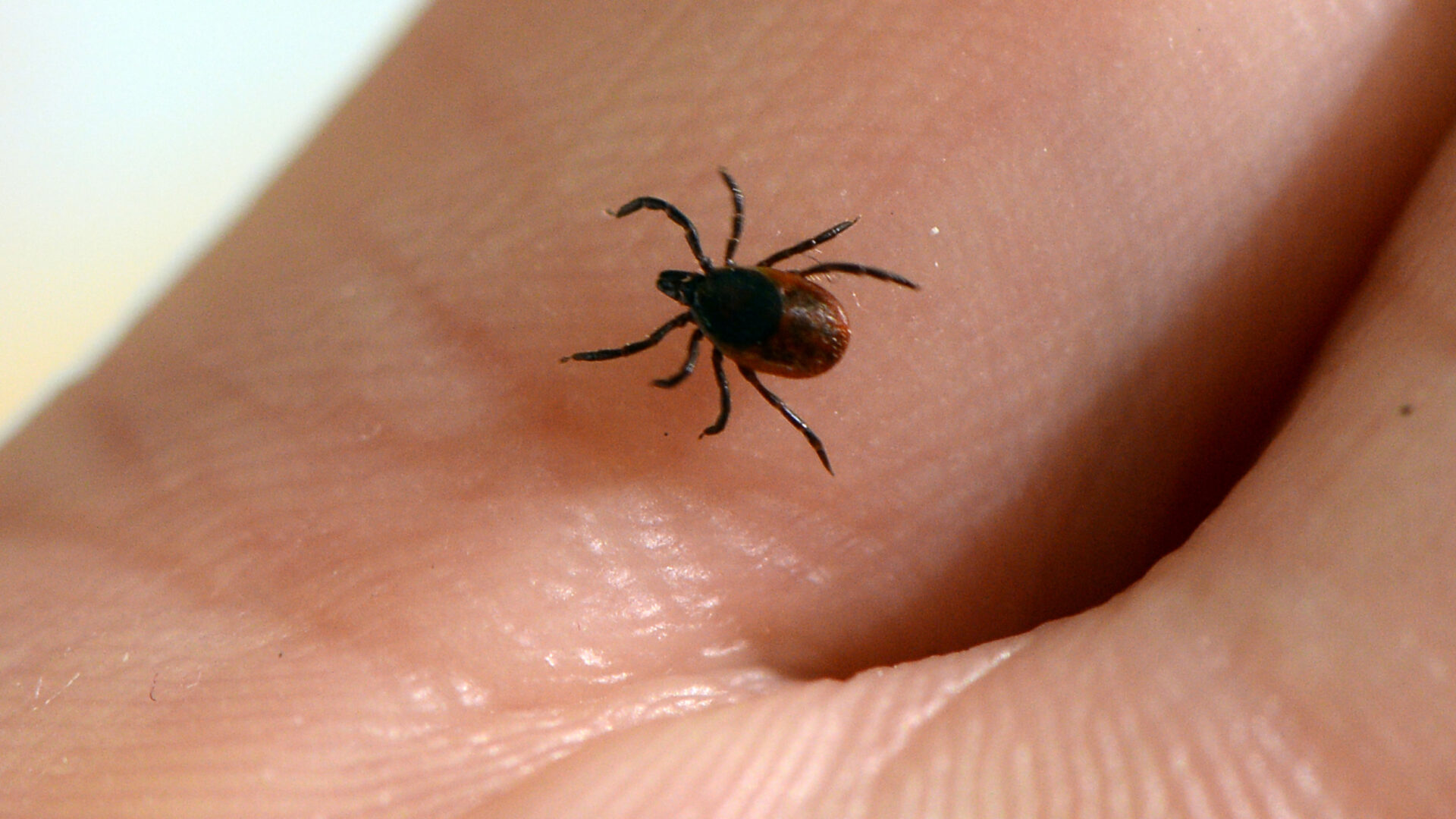 A picture taken at the French National Institute of Agricultural Research (INRA) in Maison-Alfort, on July 20, 2016 shows a tick, whose bite can transmit the Lyme disease. (Photo by BERTRAND GUAY / AFP) (Photo by BERTRAND GUAY/AFP via Getty Images)