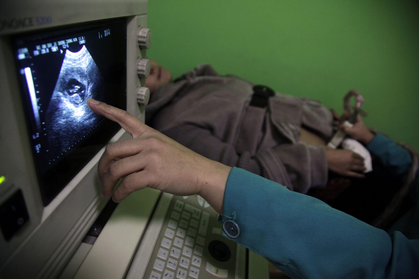In this photo taken Monday, Dec. 13, 2010, a nurse points out the image of a three-month-old fetus during a sonogram scan for 